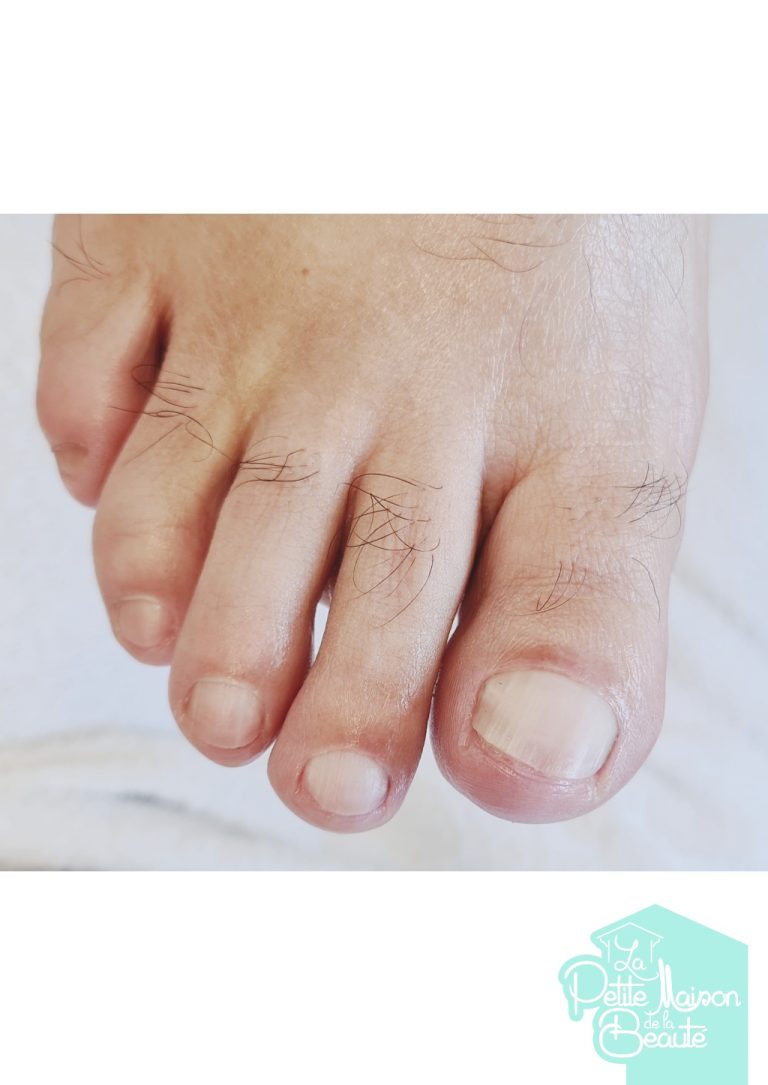 Soin des Ongles des Pieds
