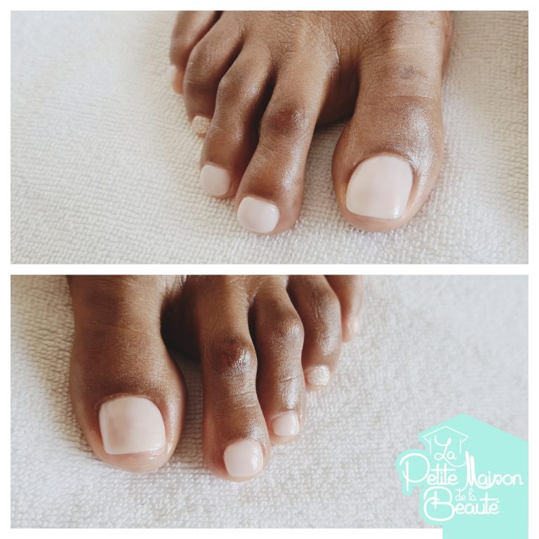 Soin des Ongles des Pieds avec Application de Vernis Semi-permanent